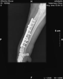Plated and screwed ulna and radius.