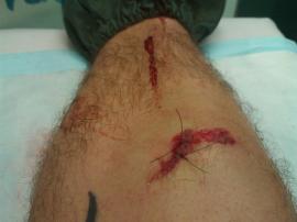 Two stitches and some glue.