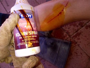 I "treated" Linhda's cut. She wasn't impressed that there was no picture of a human on the bottle that I "treated" her with.